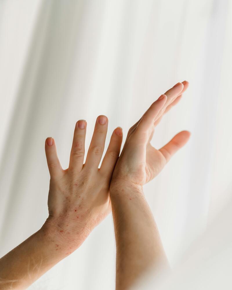 what causes brittle nails and ridges