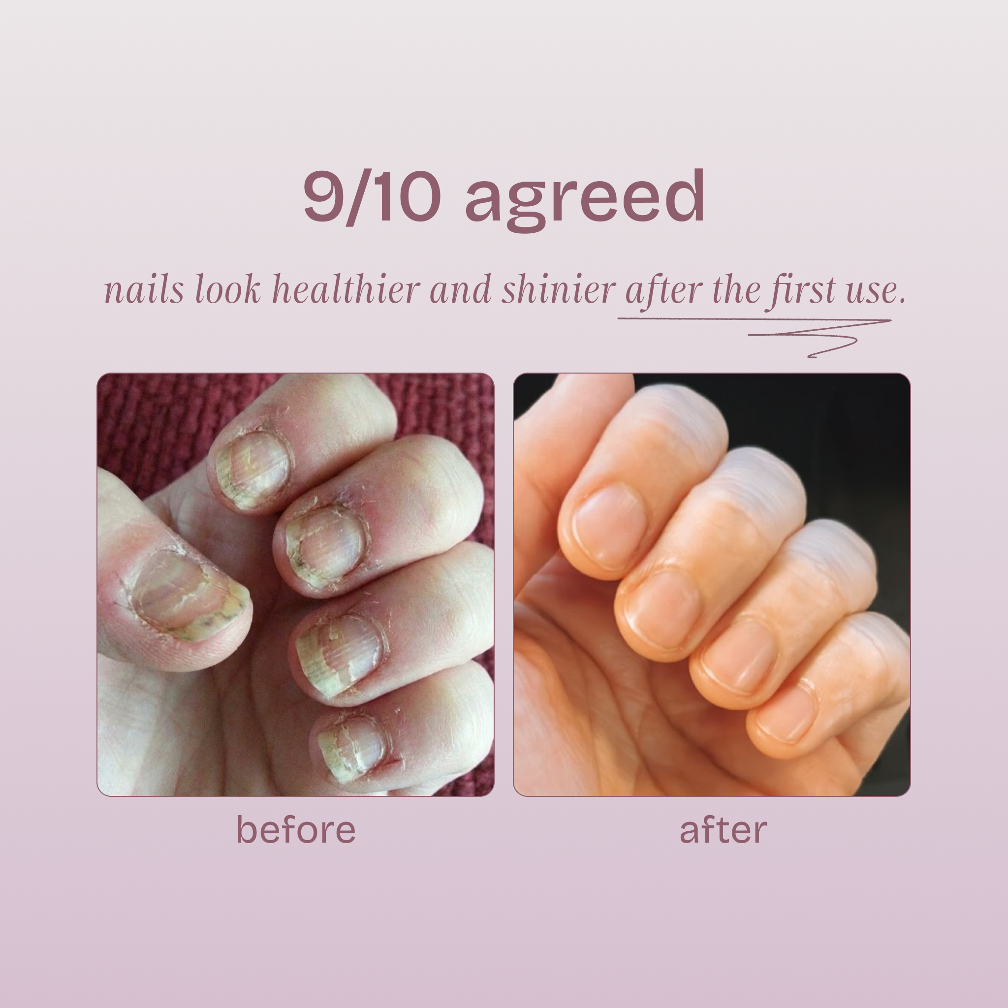 Hydrating Nail Patches