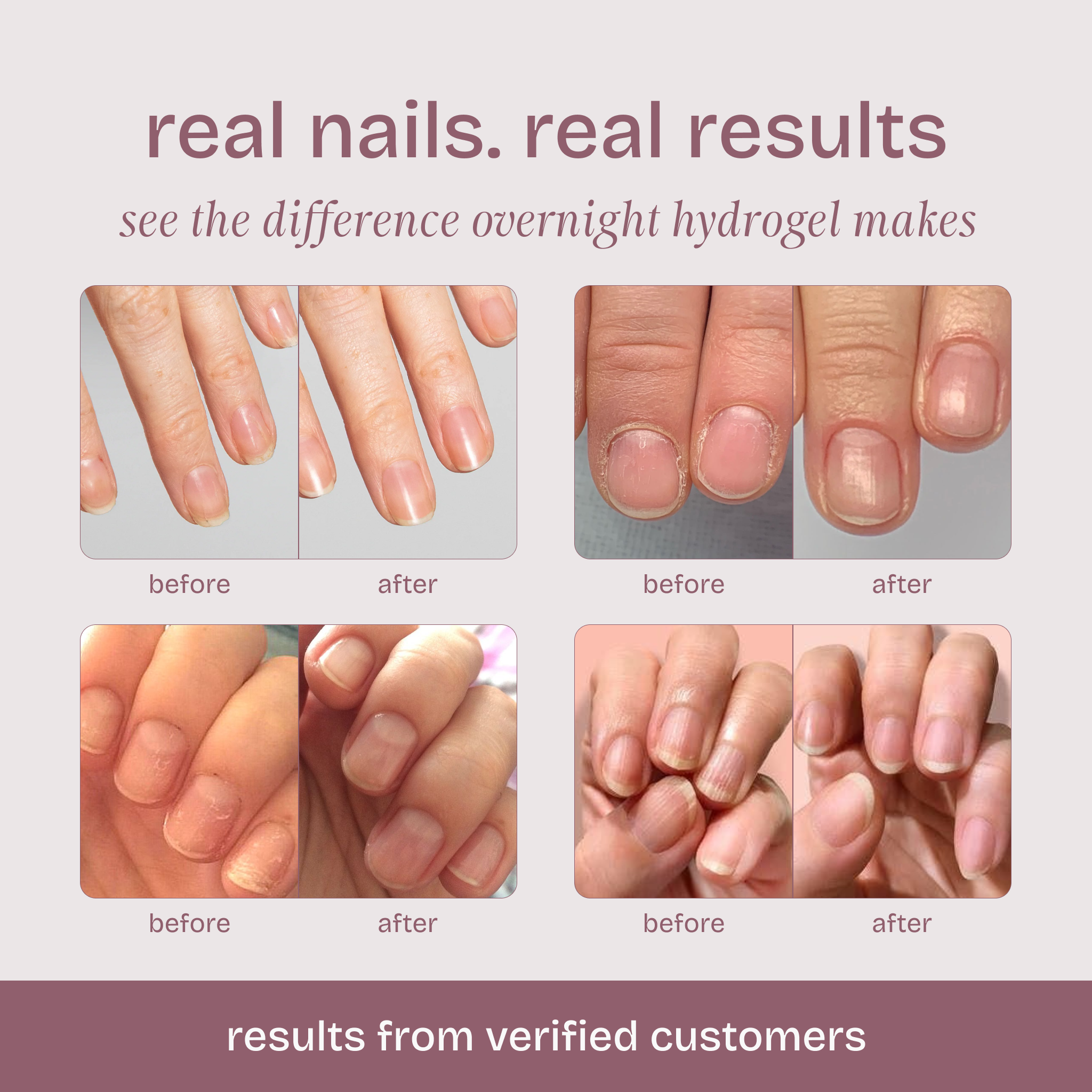 Hydrating Nail Patches